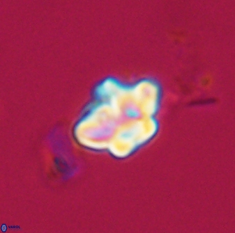 Olladiscoaster molae 32455