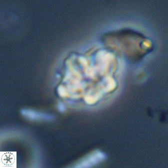 Olladiscoaster molae 32436