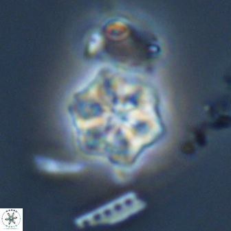 Olladiscoaster molae 32437