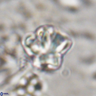 Olladiscoaster perplexus 30578