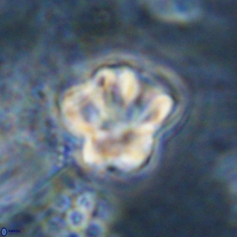 Olladiscoaster perplexus 30579