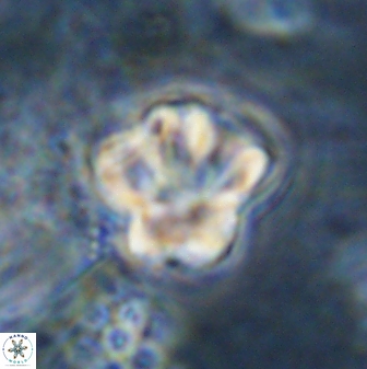 Olladiscoaster perplexus 30579