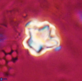 Olladiscoaster perplexus 30580