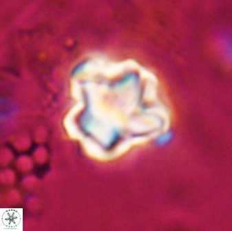 Olladiscoaster perplexus 30580