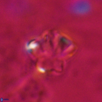 Olladiscoaster perplexus 30582