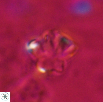 Olladiscoaster perplexus 30582
