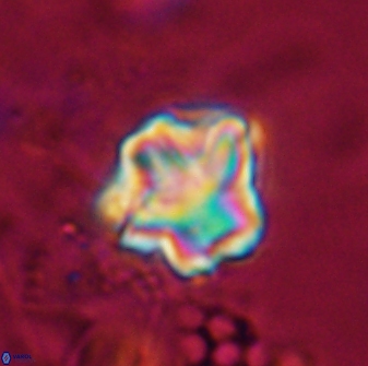 Olladiscoaster perplexus 30585