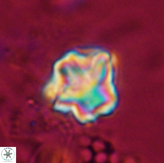 Olladiscoaster perplexus 30585