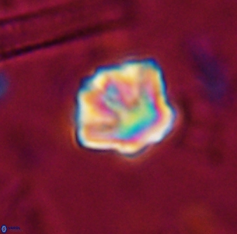 Olladiscoaster perplexus 30643