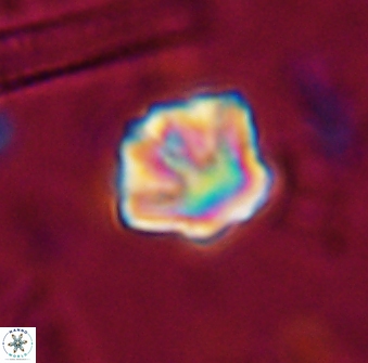 Olladiscoaster perplexus 30643