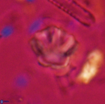 Olladiscoaster perplexus 30645