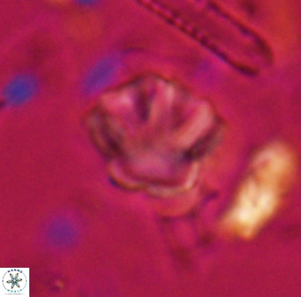 Olladiscoaster perplexus 30645