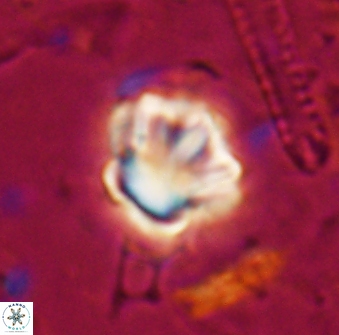 Olladiscoaster perplexus 30649