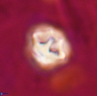 Olladiscoaster perplexus 30650