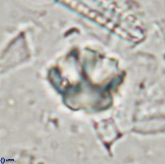 Olladiscoaster perplexus 30655