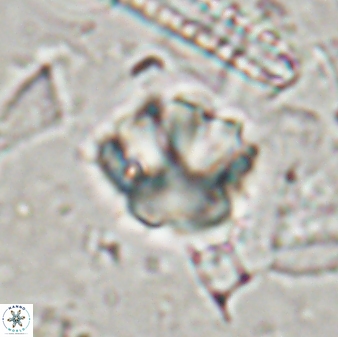 Olladiscoaster perplexus 30655