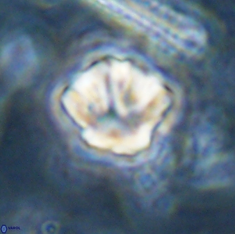 Olladiscoaster perplexus 30660