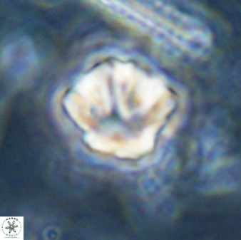 Olladiscoaster perplexus 30660