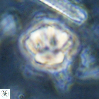 Olladiscoaster perplexus 30661