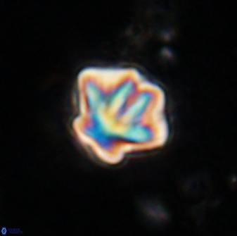 Olladiscoaster perplexus 30785