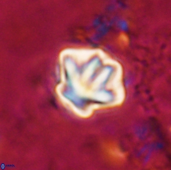 Olladiscoaster perplexus 30786