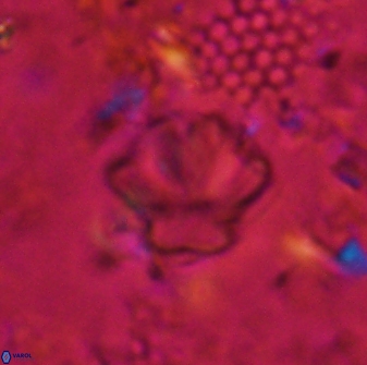 Olladiscoaster perplexus 30787