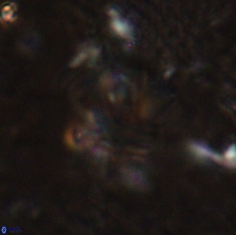 Olladiscoaster perplexus 30788