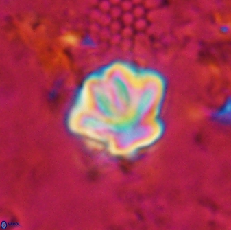 Olladiscoaster perplexus 30789