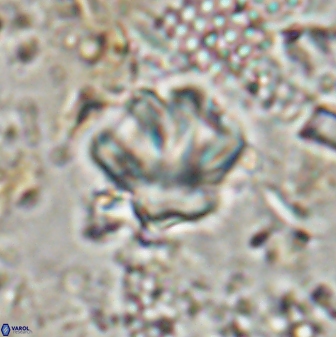 Olladiscoaster perplexus 30791