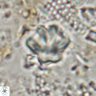 Olladiscoaster perplexus 30791