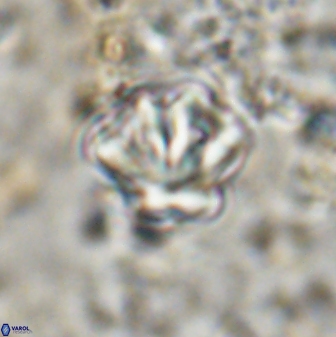 Olladiscoaster perplexus 30792