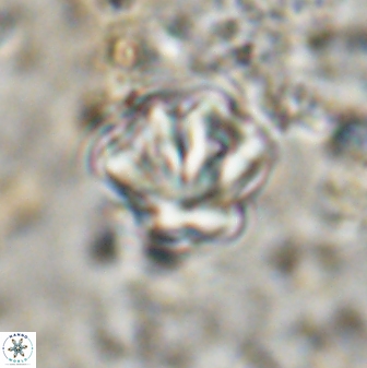 Olladiscoaster perplexus 30792