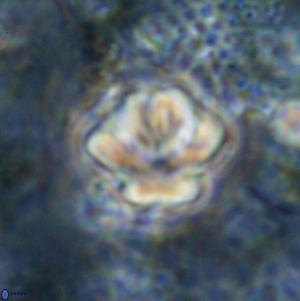 Olladiscoaster perplexus 30793