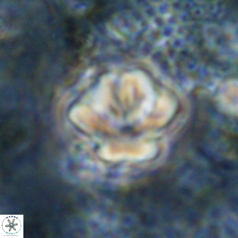 Olladiscoaster perplexus 30793