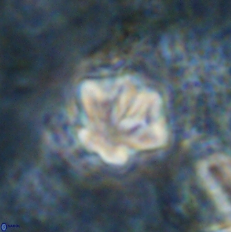 Olladiscoaster perplexus 30794