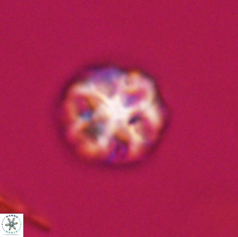 Olladiscoaster perplexus 32400
