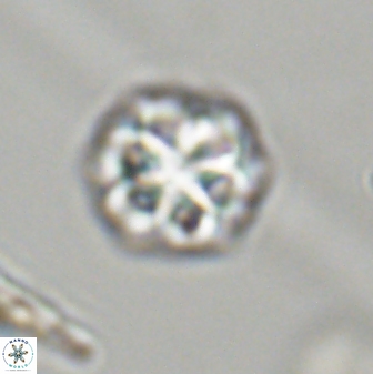 Olladiscoaster perplexus 32402