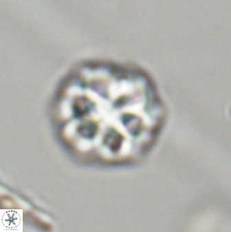 Olladiscoaster perplexus 32403