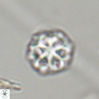 Olladiscoaster perplexus 32407