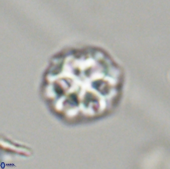 Olladiscoaster perplexus 32408