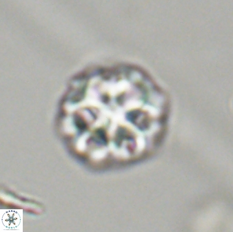 Olladiscoaster perplexus 32408