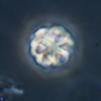 Olladiscoaster perplexus 32409