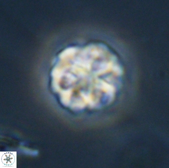 Olladiscoaster perplexus 32409