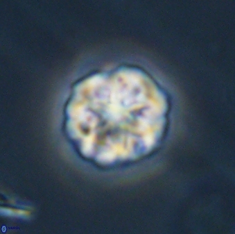 Olladiscoaster perplexus 32410