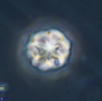 Olladiscoaster perplexus 32411