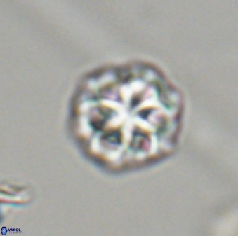 Olladiscoaster perplexus 32412