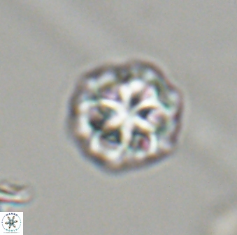 Olladiscoaster perplexus 32412