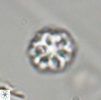 Olladiscoaster perplexus 32413