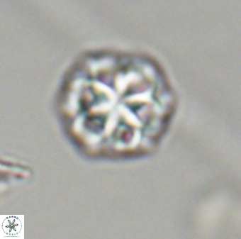 Olladiscoaster perplexus 32415