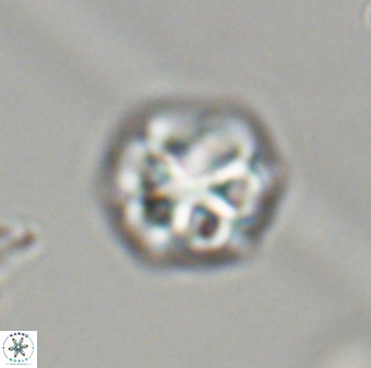 Olladiscoaster perplexus 32416
